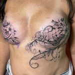 Mastectomy Art